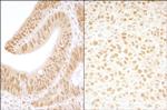 CKII beta Polyclonal Antibody