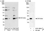 CKII beta Polyclonal Antibody
