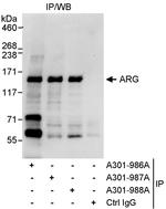 ARG Antibody in Immunoprecipitation (IP)