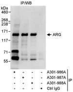 ARG Polyclonal Antibody