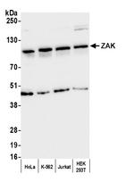 ZAK Polyclonal Antibody