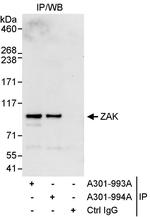 ZAK Antibody in Immunoprecipitation (IP)