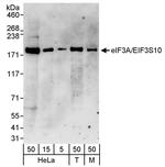 eIF3A/eIF3S10 Polyclonal Antibody