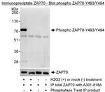 Phospho-ZAP70 (Tyr493, Tyr494) Antibody in Immunoprecipitation (IP)