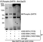 Phospho-ZAP70 (Tyr493, Tyr494) Antibody in Immunoprecipitation (IP)