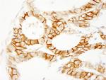 Beta-catenin Antibody in Immunohistochemistry (Paraffin) (IHC (P))