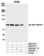 Beta-catenin Antibody in Immunoprecipitation (IP)