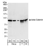 Beta-catenin Antibody in Western Blot (WB)