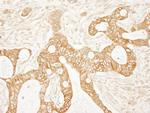 Beta-catenin Antibody in Immunohistochemistry (Paraffin) (IHC (P))