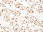 KSRP Polyclonal Antibody