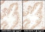 RanGAP1 Polyclonal Antibody