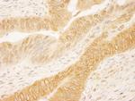 RanGAP1 Antibody in Immunohistochemistry (Paraffin) (IHC (P))