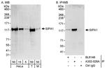 SIPA1 Polyclonal Antibody