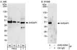 ArfGAP1 Polyclonal Antibody