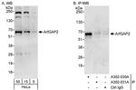 ArfGAP2 Polyclonal Antibody