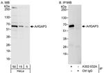 ArfGAP3 Polyclonal Antibody
