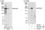 ASXL2 Polyclonal Antibody