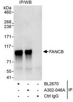 FANCB Polyclonal Antibody