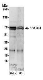 FBXO31 Polyclonal Antibody