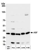 ASF Polyclonal Antibody