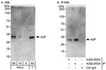 ASF Polyclonal Antibody