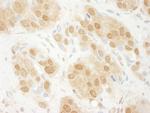 ERK1 Antibody in Immunohistochemistry (Paraffin) (IHC (P))