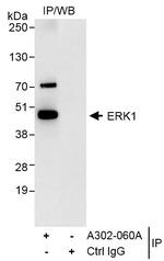 ERK1 Antibody in Immunoprecipitation (IP)