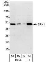 ERK1 Antibody in Western Blot (WB)