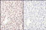 Phospho-RelA (Ser468) Antibody in Immunohistochemistry (Paraffin) (IHC (P))
