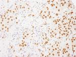 RALY Polyclonal Antibody