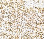 RALY Antibody in Immunohistochemistry (Paraffin) (IHC (P))