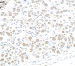 RALY Polyclonal Antibody