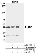 RALY Antibody in Immunoprecipitation (IP)
