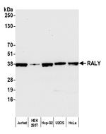 RALY Antibody in Western Blot (WB)