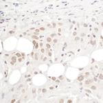 hPrp3p Antibody in Immunohistochemistry (Paraffin) (IHC (P))
