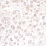 hPrp3p Polyclonal Antibody