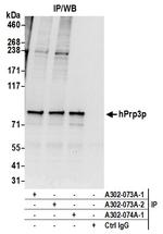 hPrp3p Antibody in Immunoprecipitation (IP)