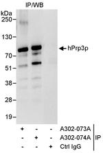 hPrp3p Polyclonal Antibody