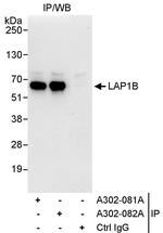 LAP1B Antibody in Immunoprecipitation (IP)