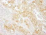 Notch2 Polyclonal Antibody