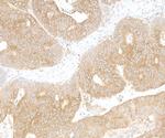 LARP1 Polyclonal Antibody
