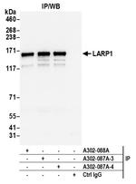LARP1 Antibody in Immunoprecipitation (IP)