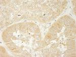 LARP1 Polyclonal Antibody