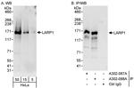 LARP1 Antibody in Western Blot (WB)