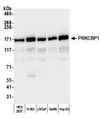 PRKCBP1 Polyclonal Antibody