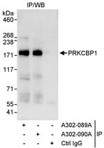 PRKCBP1 Polyclonal Antibody