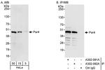 Par4 Polyclonal Antibody