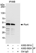Par4 Polyclonal Antibody