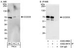 CCDC6 Polyclonal Antibody