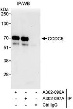 CCDC6 Polyclonal Antibody